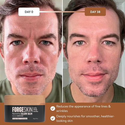 Forge Skin Beef Tallow Balm Moisturizer for Men Skin Care